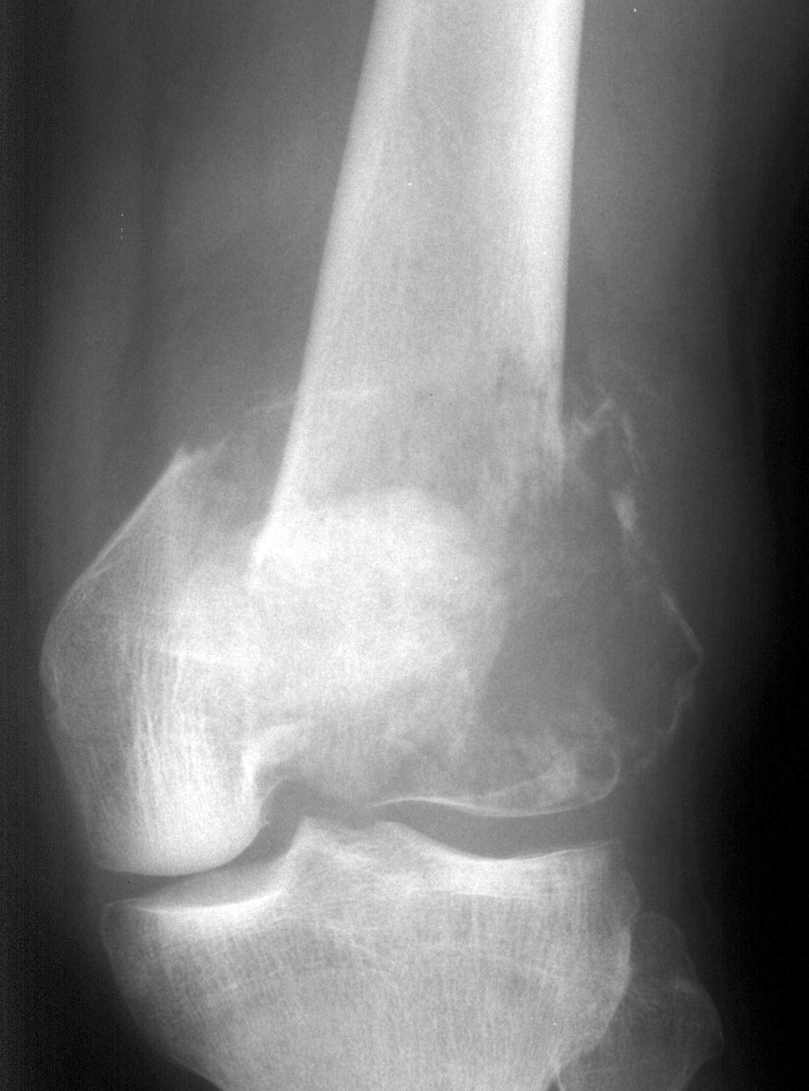 1. AP knee