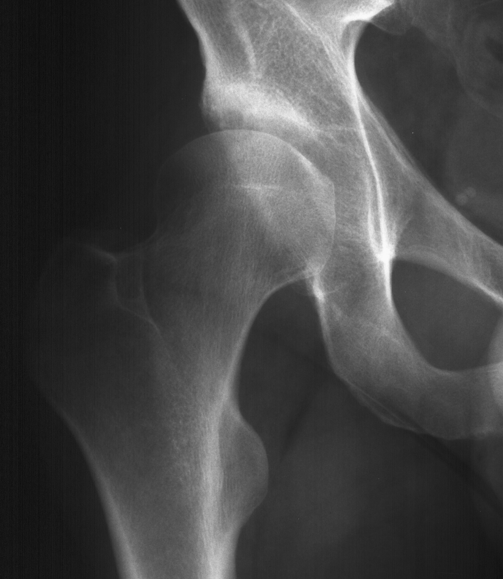 X-ray