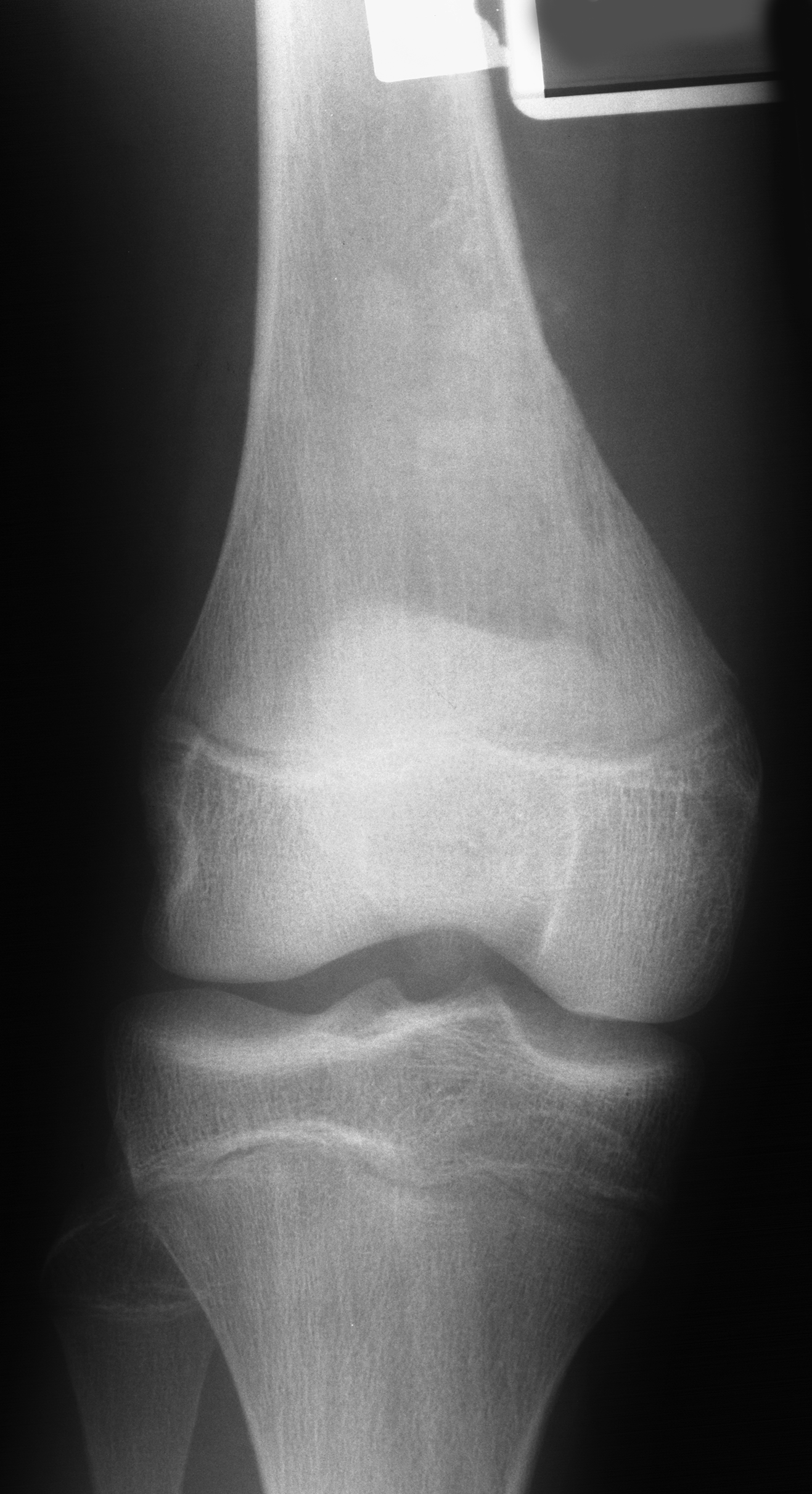 1. AP knee