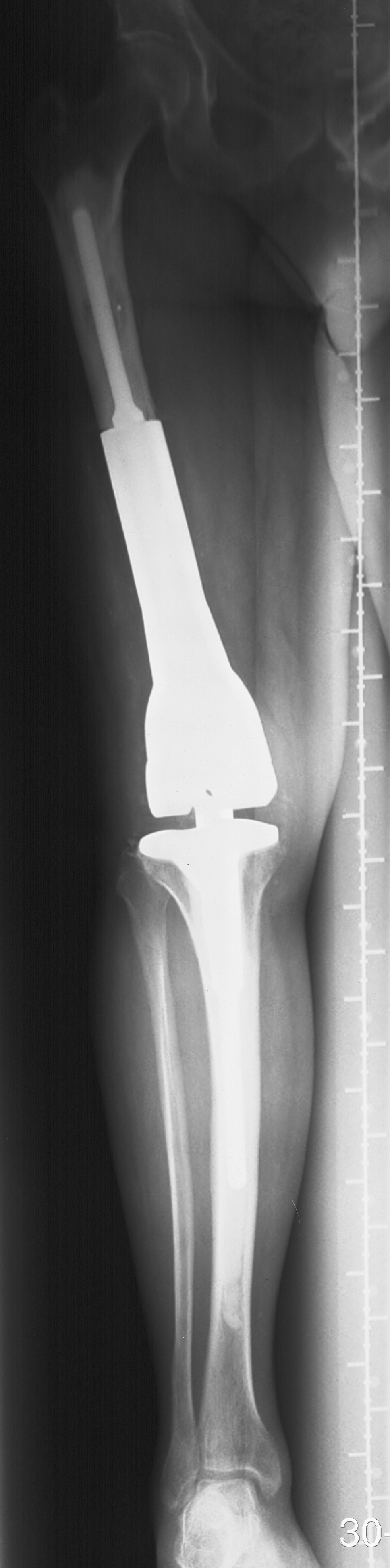 1. AP lower limb