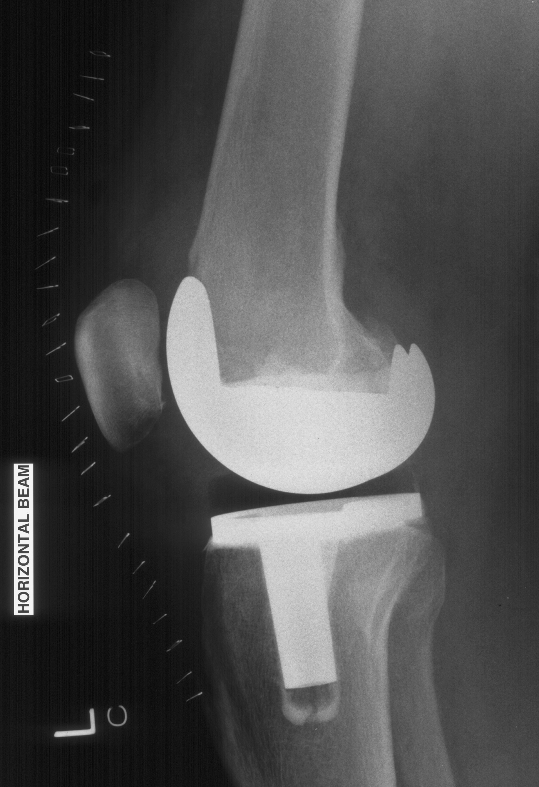 1. Lateral radiograph