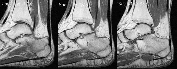 1. Sag T1W