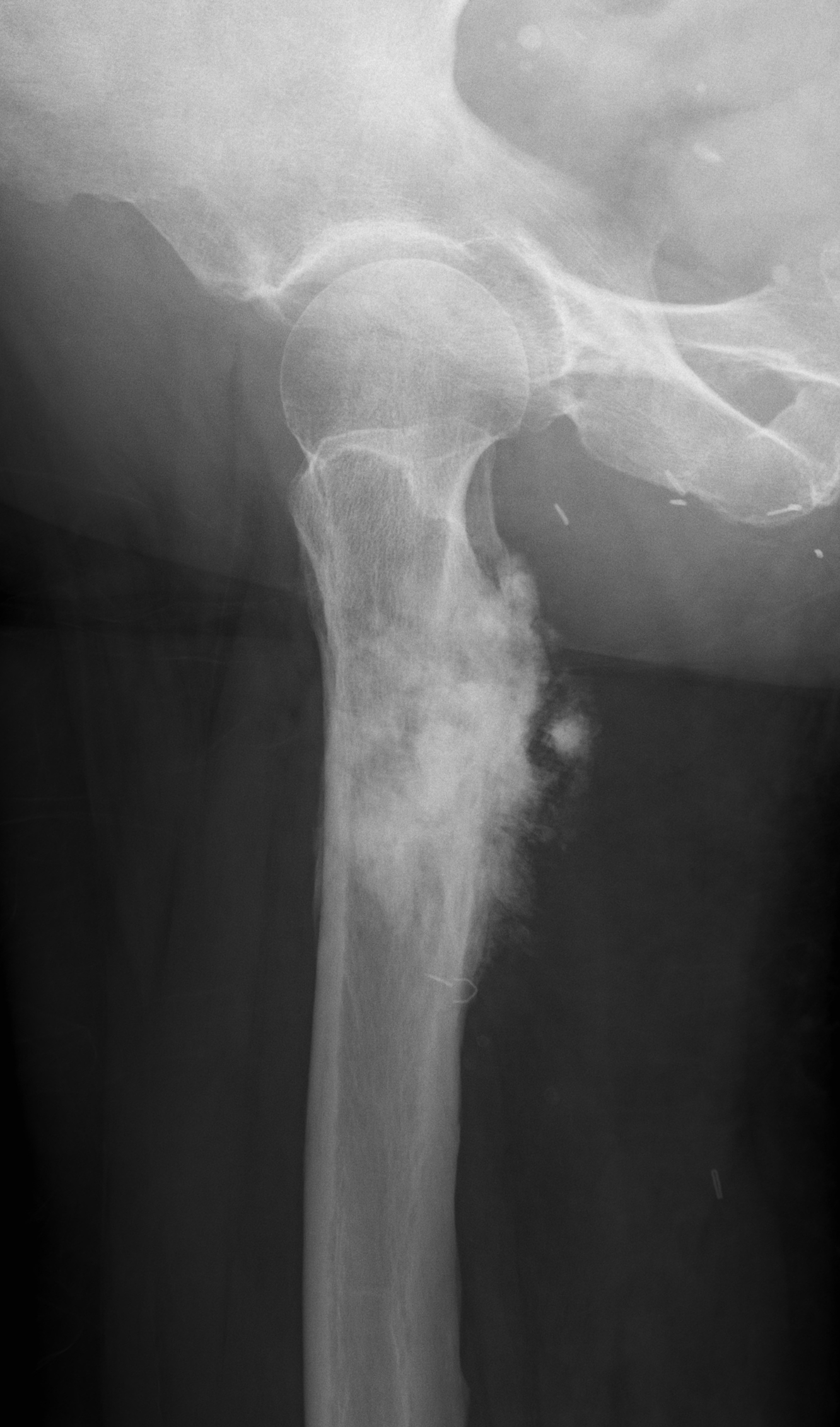 | Lateral hip